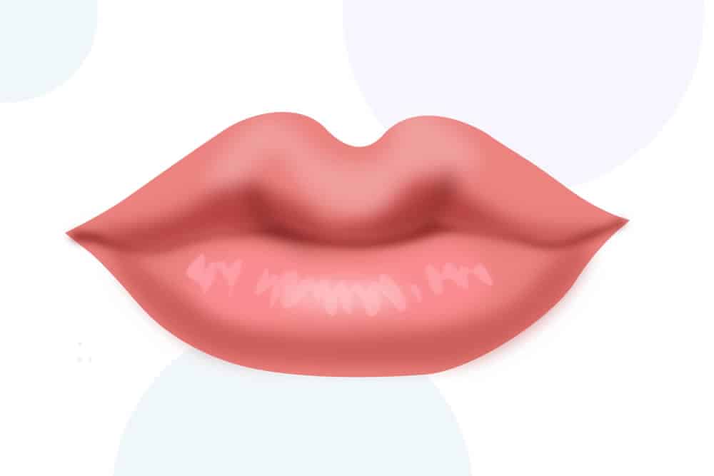 唇の全体的なボリュームアップのイメージ