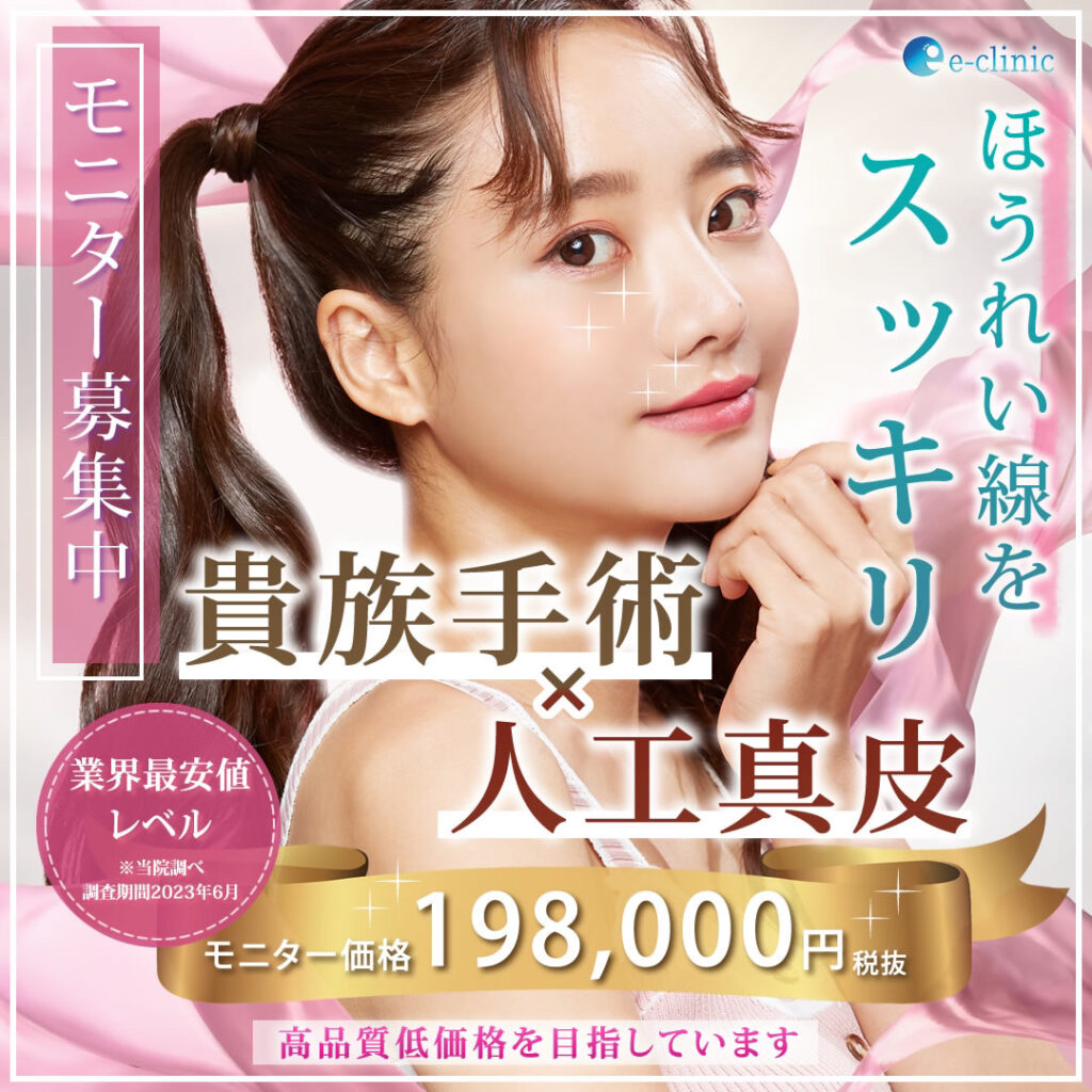 ほうれい線をスッキリ　貴族手術×人工真皮　モニター募集