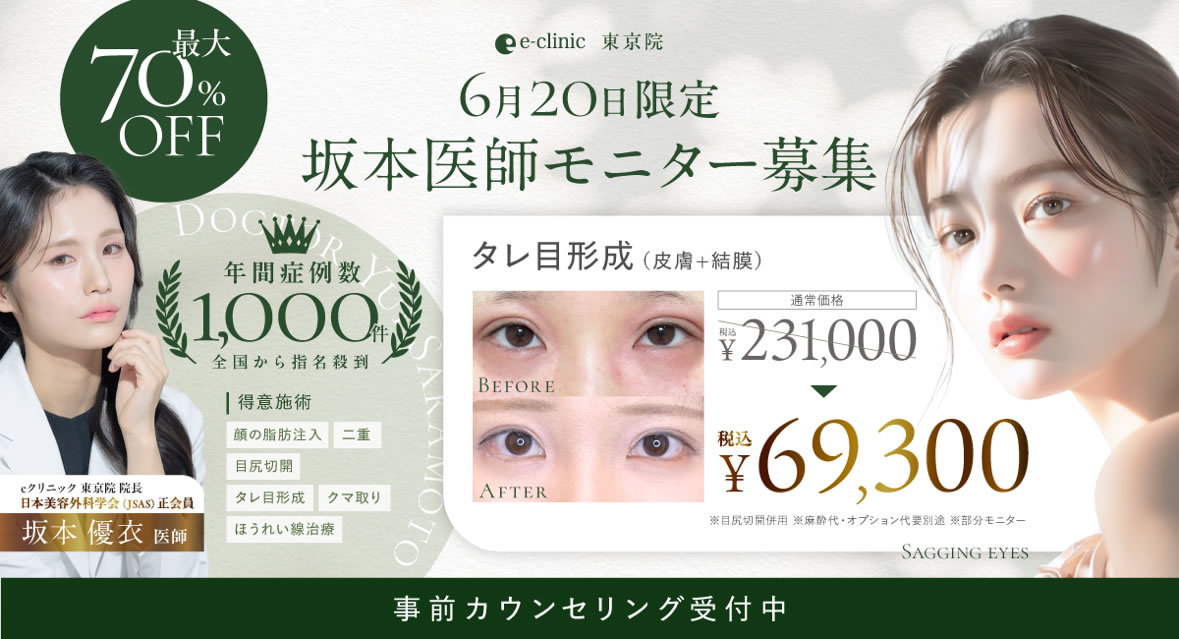 タレ目形成のモニターキャンペーン