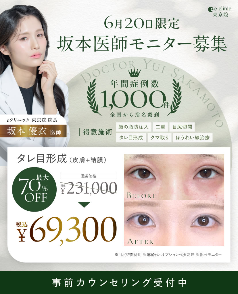 タレ目形成のモニターキャンペーン
