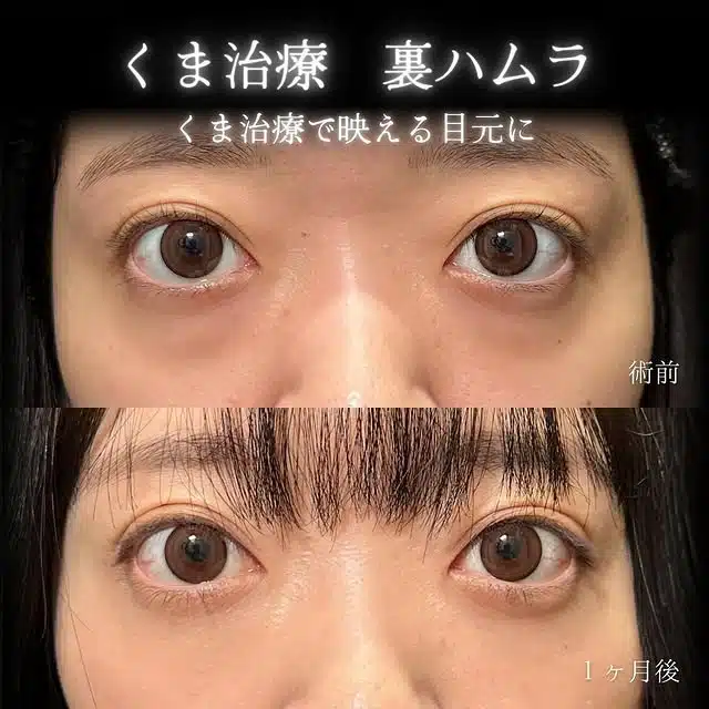 クマ取り 裏ハムラ 東京