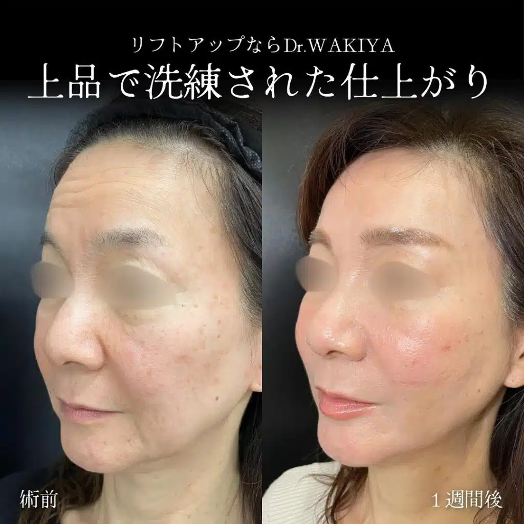 上品で洗練された仕上がり 東京