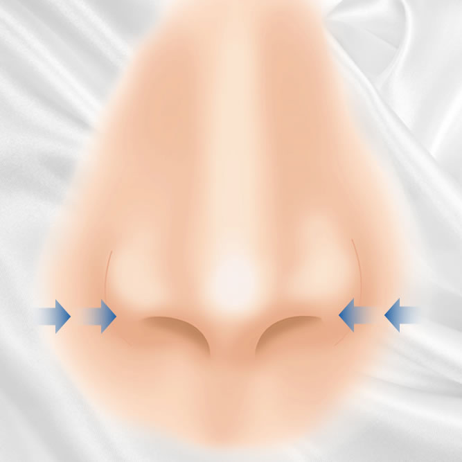小鼻縮小のイメージ