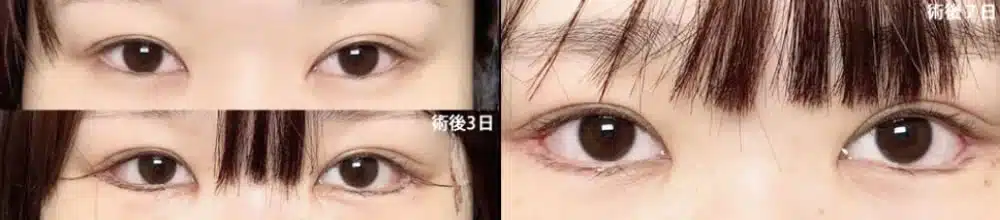 白目の露出を広げるデザイン　東京
