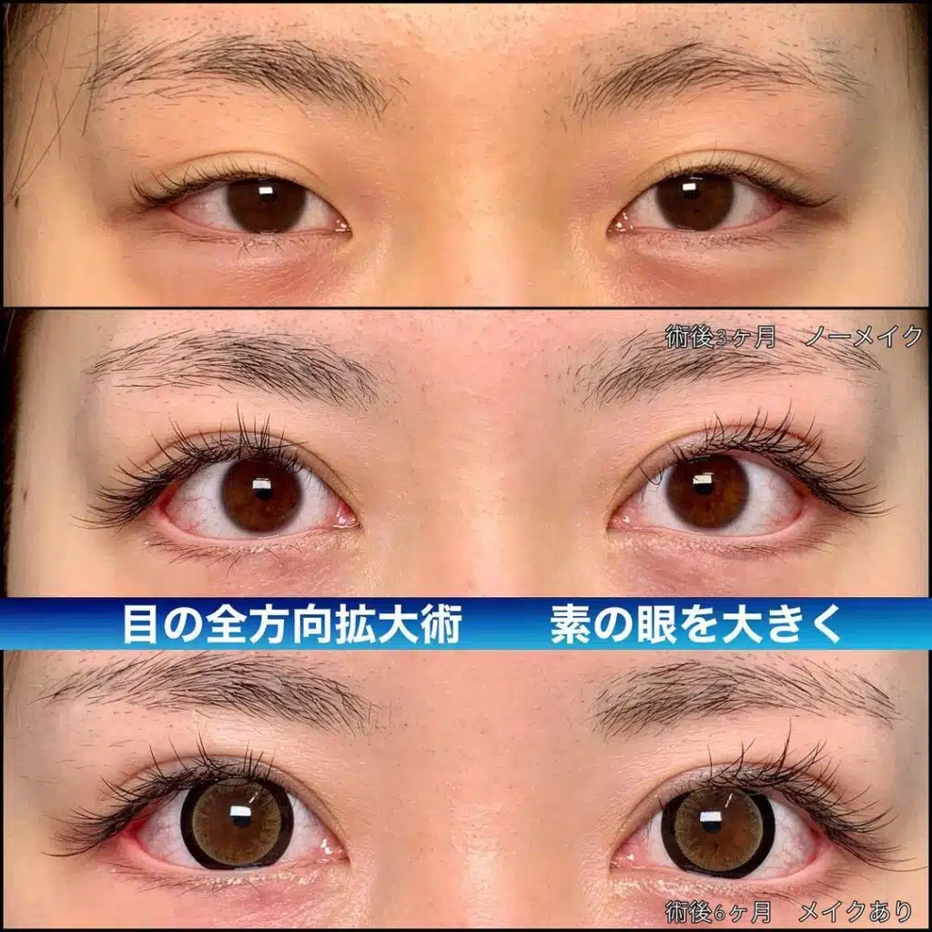 目の全方向拡大術 東京