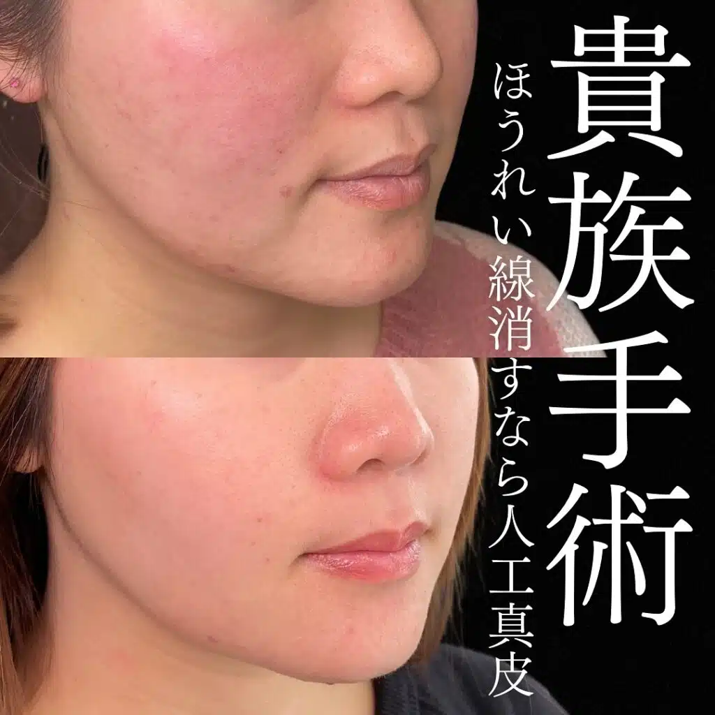 貴族手術 東京