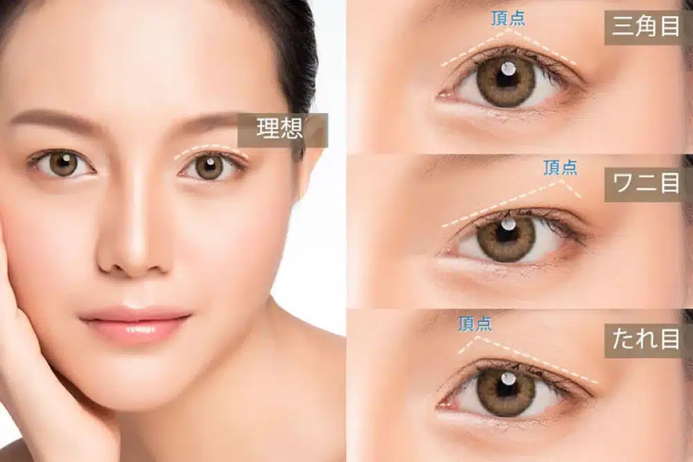 眼瞼下垂の失敗例の説明 東京