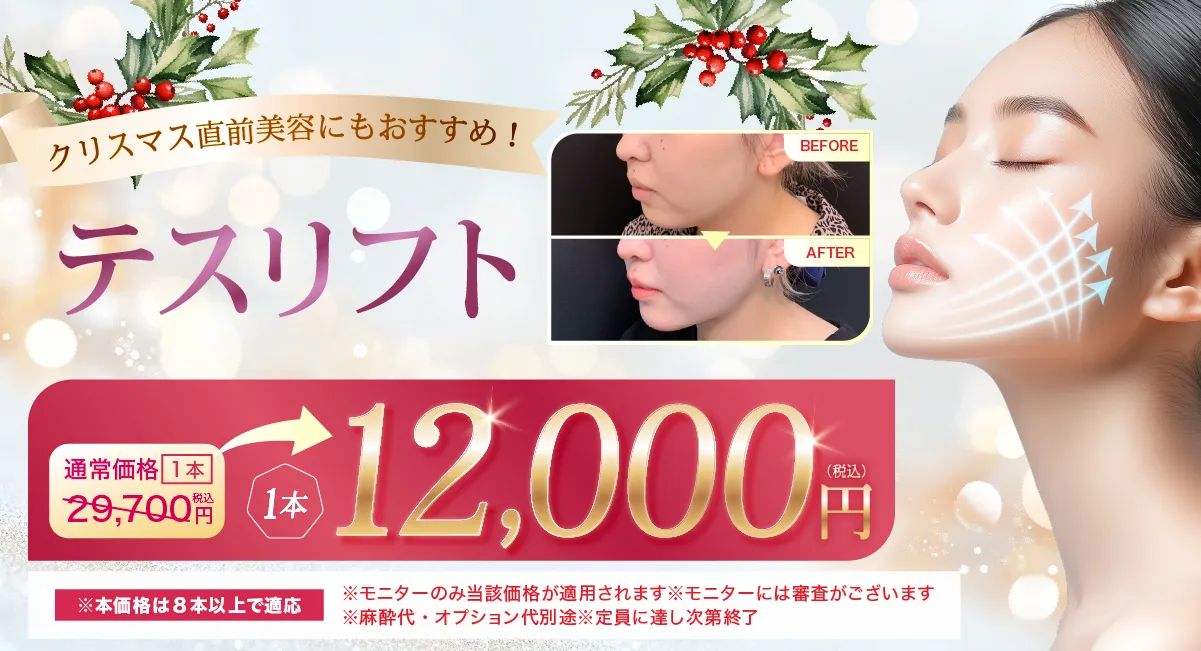 閑散期テスリフトCP