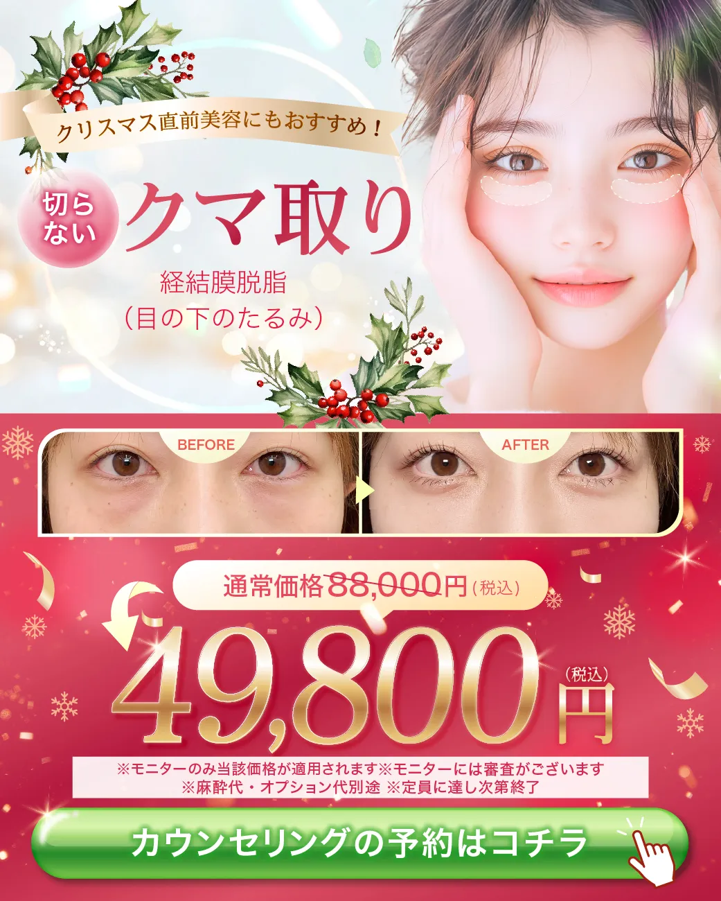 閑散期クマ取りCP