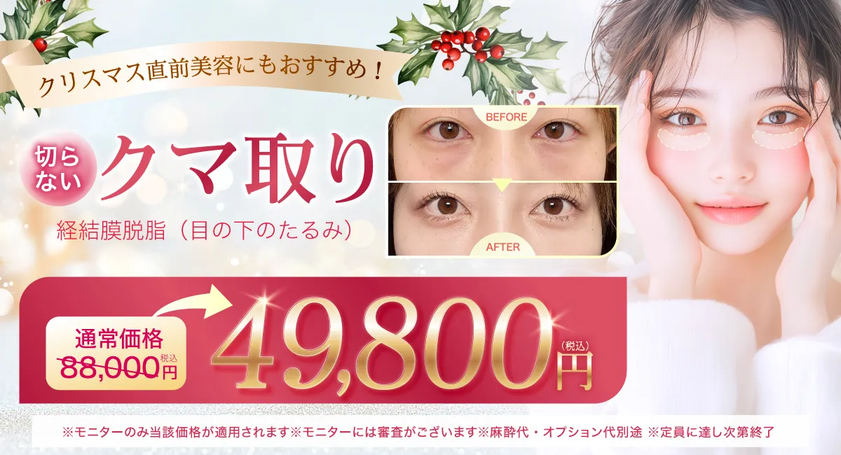 閑散期クマ取りCP