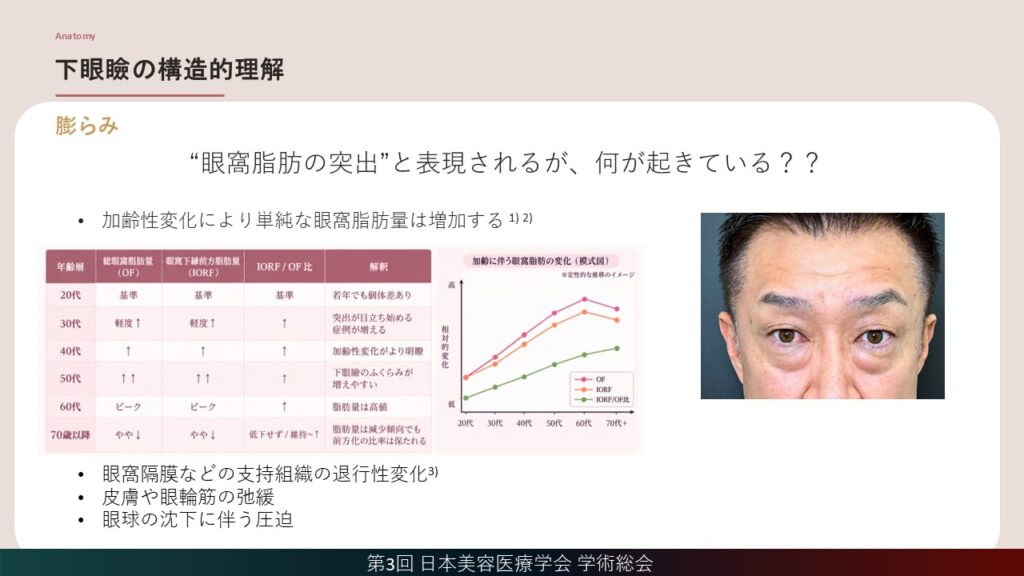 3_下眼瞼の構造的理解